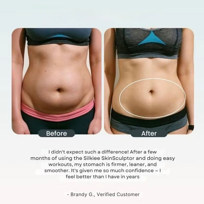 SculptCup Pro Anti-Cellulite Body Massager