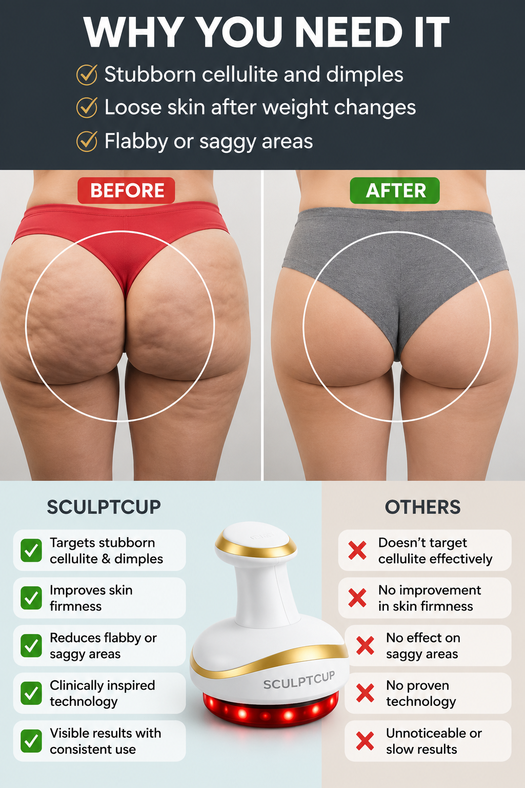 SculptCup Pro Anti-Cellulite Body Massager